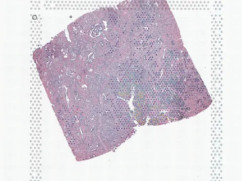 Human prostate gland preview
