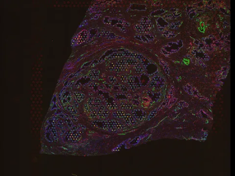Human prostate gland preview