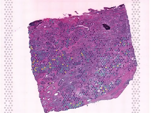 Human prostate gland preview
