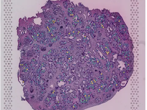 Human prostate gland preview