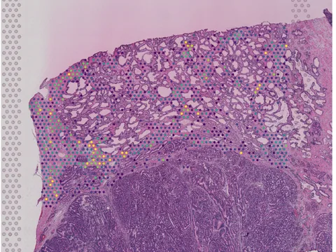 Human prostate gland preview