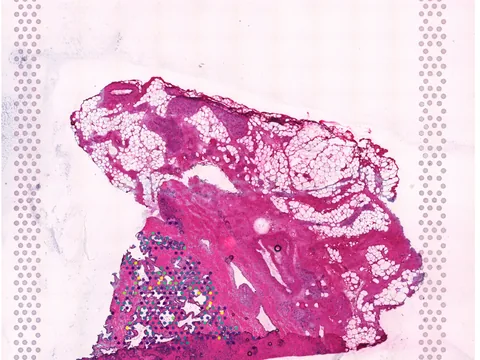 Human prostate gland preview