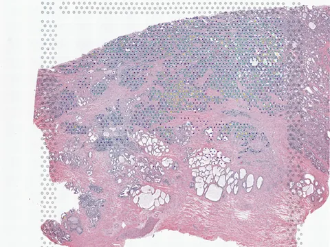 Human prostate gland preview