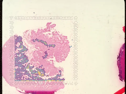 Human small intestine preview