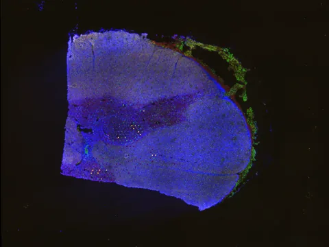 Human spinal cord preview
