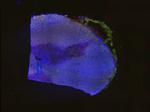 Human spinal cord preview