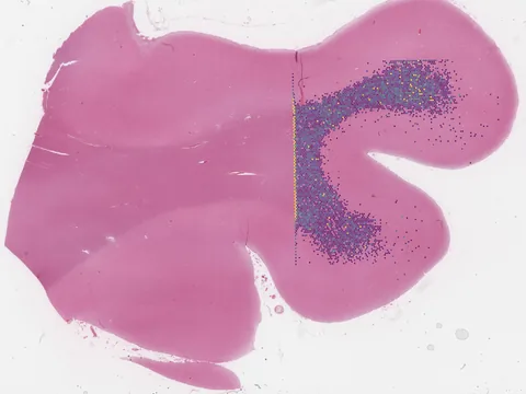 Human temporal cortex preview