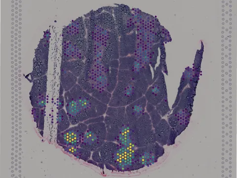 Human thymus preview