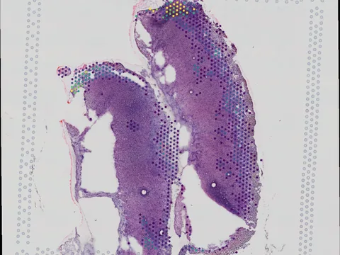 Mouse uterus preview
