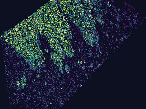 Human basal ganglion preview