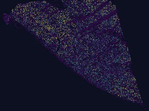 Human basal ganglion preview