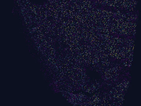 Human basal ganglion preview