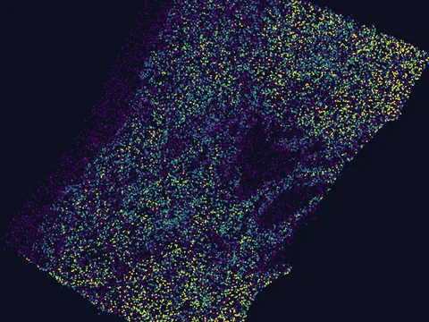 Human basal ganglion preview