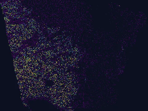 Human basal ganglion preview