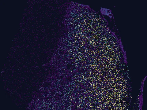 Human basal ganglion preview