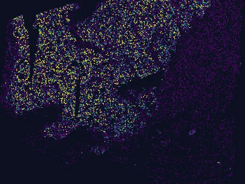 Human basal ganglion preview
