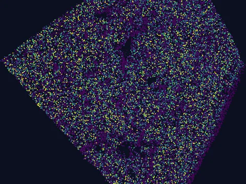 Human basal ganglion preview