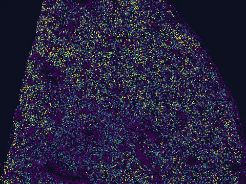 Human basal ganglion preview