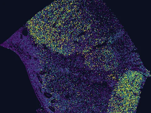 Human basal ganglion preview
