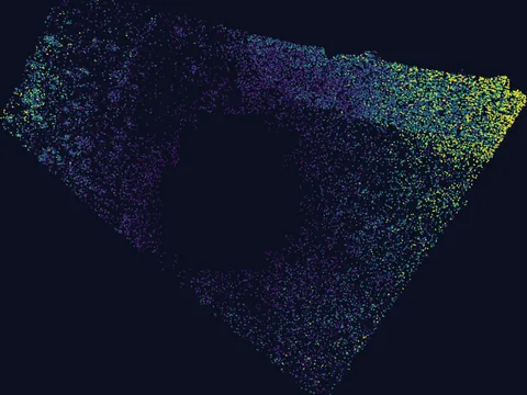Human basal ganglion preview