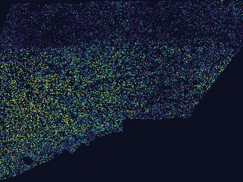 Human basal ganglion preview