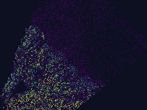 Human basal ganglion preview