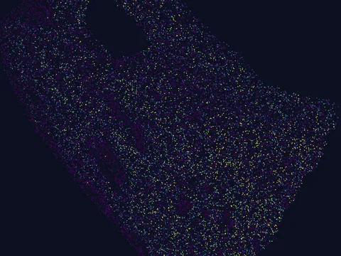 Human basal ganglion preview