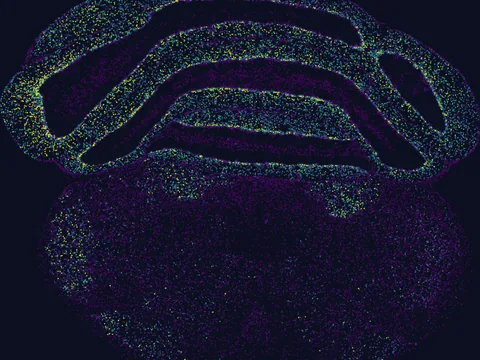 Mouse brain preview